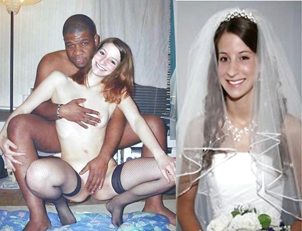 25P White Sluts  Before and After