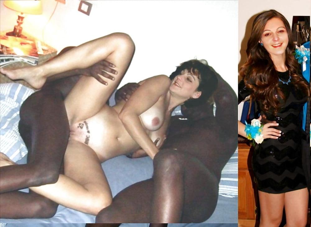 25P White Sluts  Before and After
