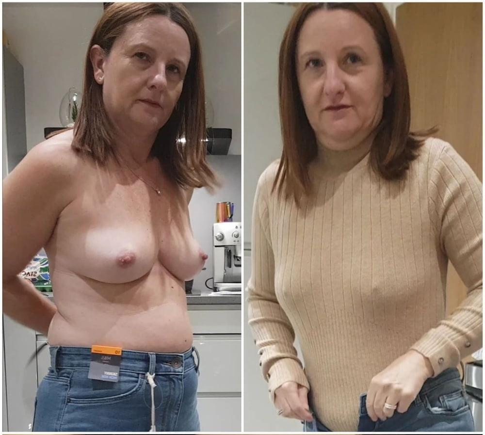 25P Dressed - Undressed (amateur) #326