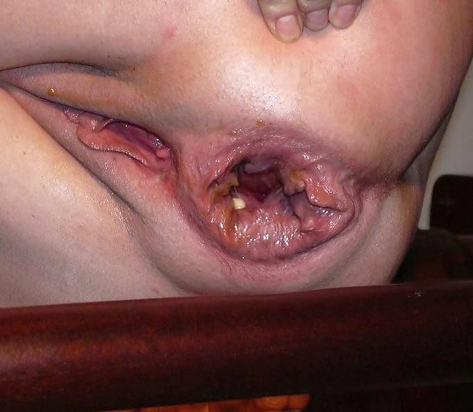 8P WORLD'S MASSIVE GAPING HOLES Vol.4 -L1390-