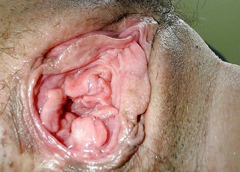 24P Gaping holes
