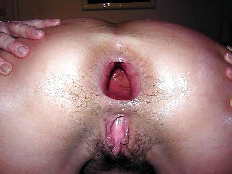 24P Gaping holes