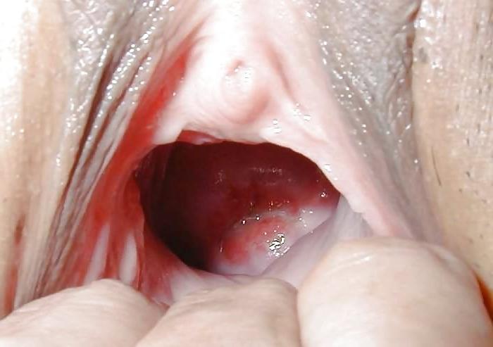 24P Gaping holes