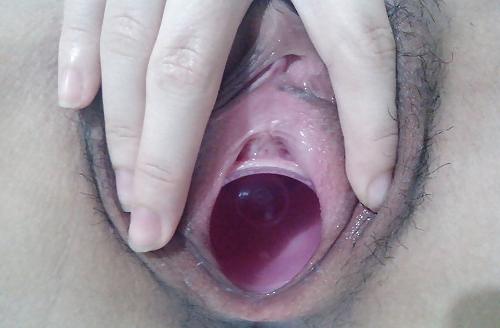 25P Gaping pussies