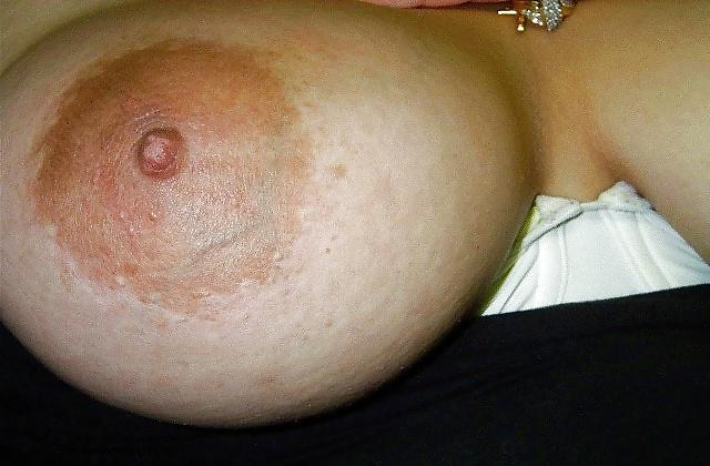 25P Huge Tits 3