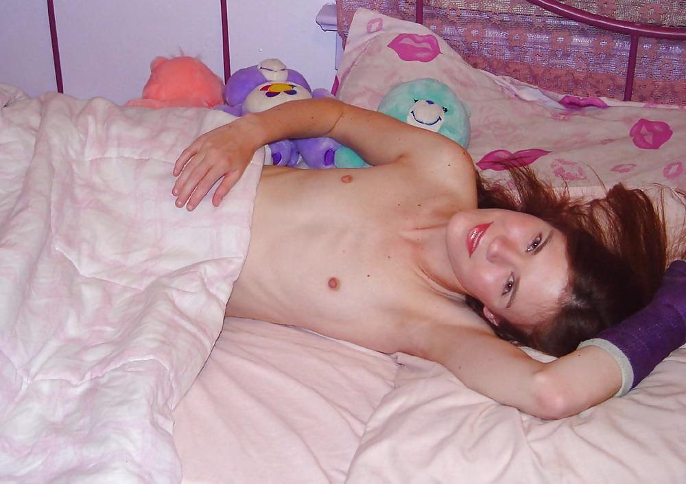 25P Slim pornstar Melissa posing with her arm in a cast