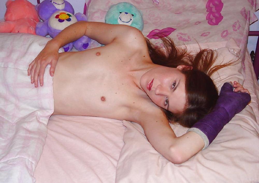 25P Slim pornstar Melissa posing with her arm in a cast