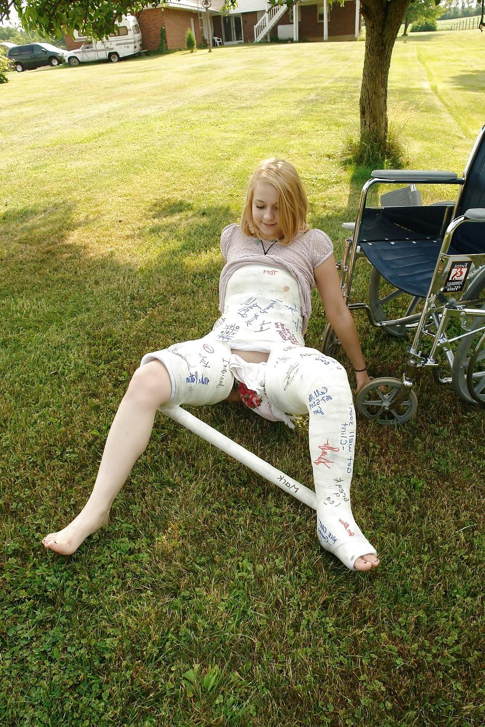 25P Gips - Cast