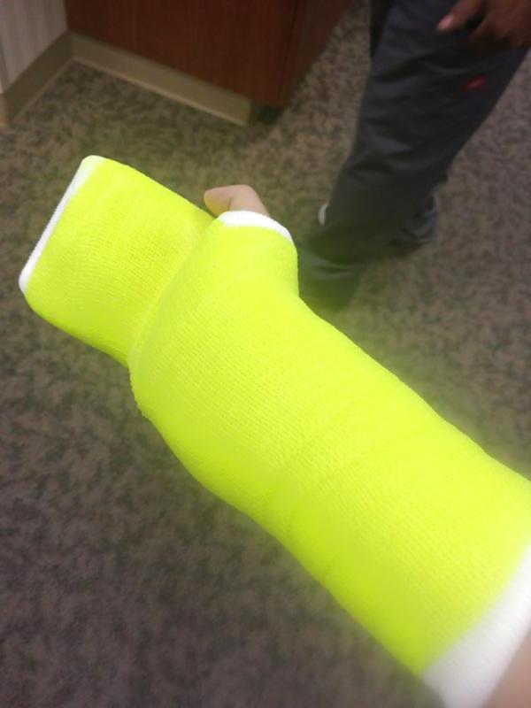 25P Gips - Cast