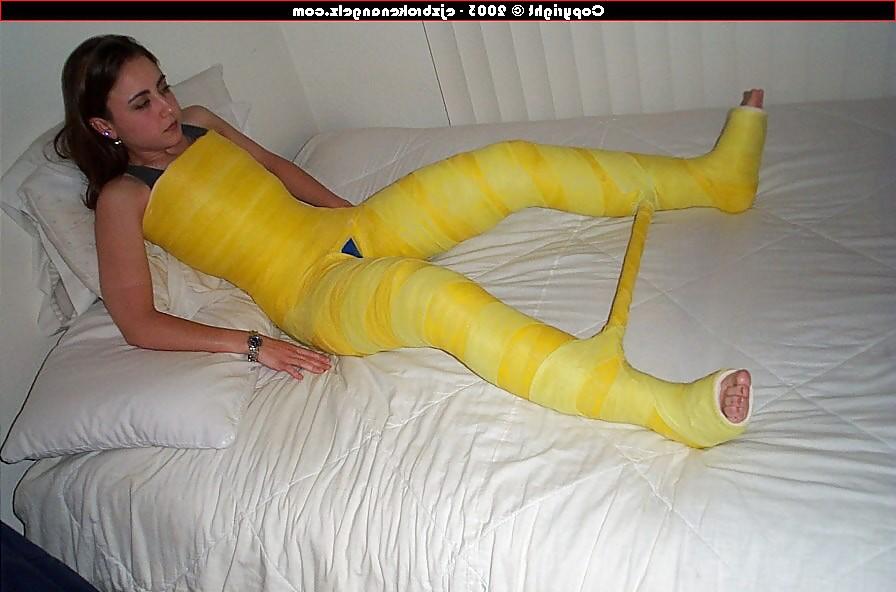 25P Gips - Cast