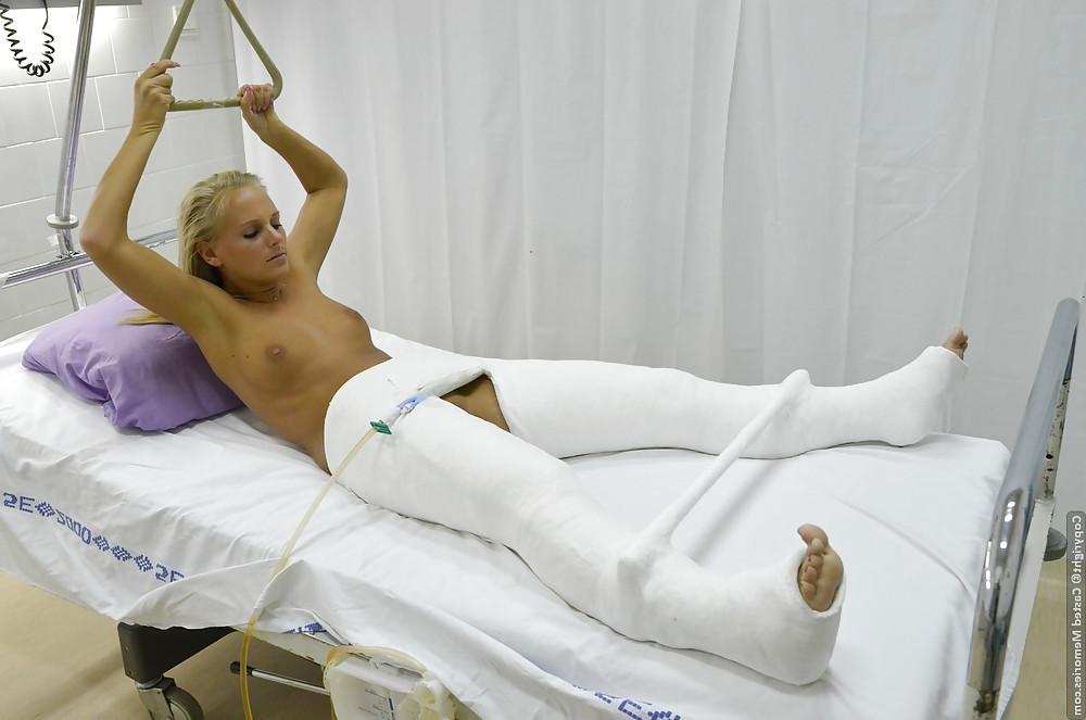 25P Gips - Cast