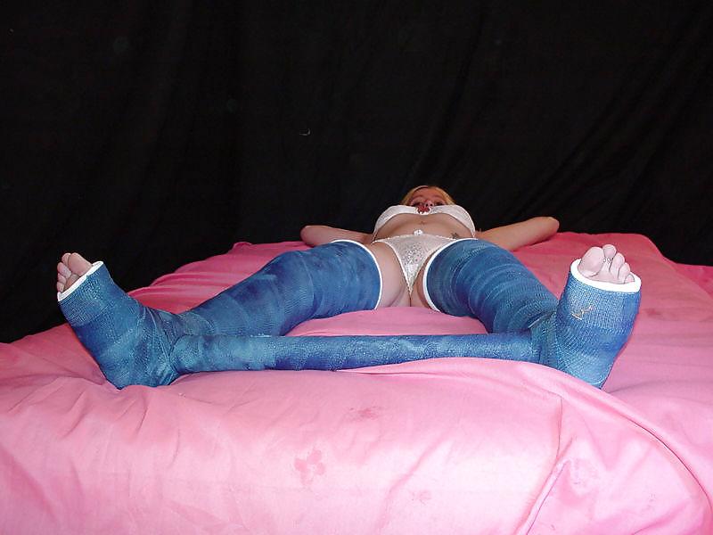 25P Gips - Cast