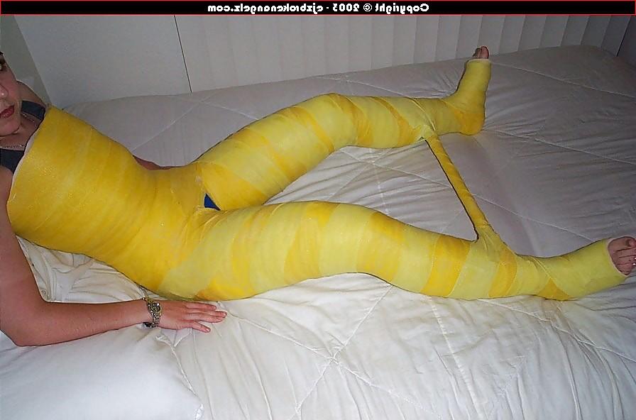 25P Gips - Cast
