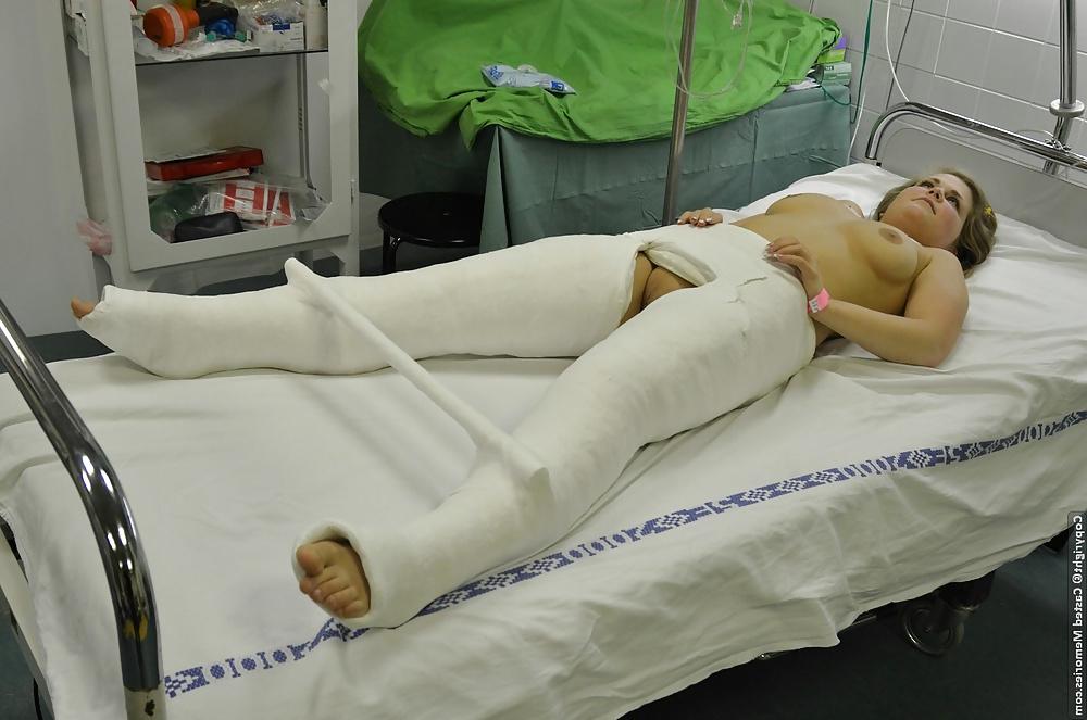 25P Gips - Cast