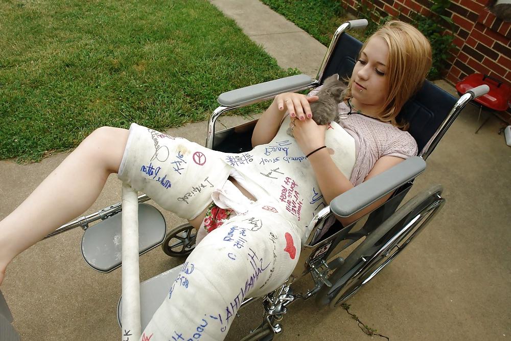 25P Gips - Cast