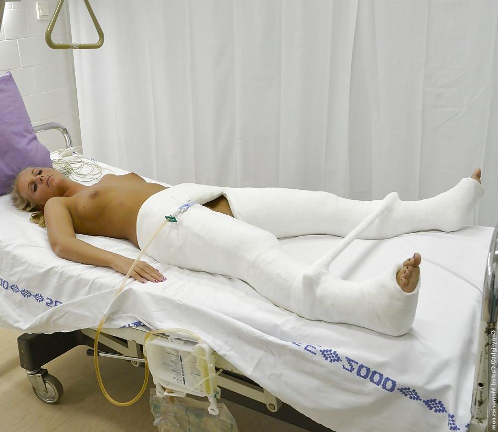 25P Gips - Cast