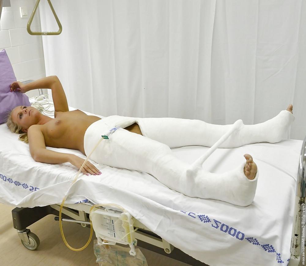 25P Gips - Cast