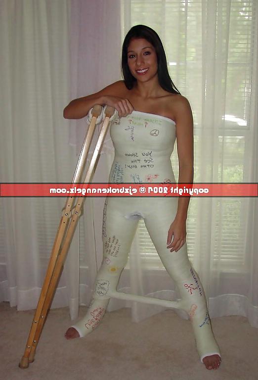 25P Gips - Cast