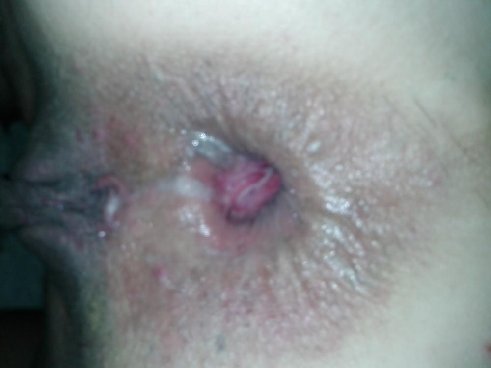 25P My sexy slut wife's gaping pussy