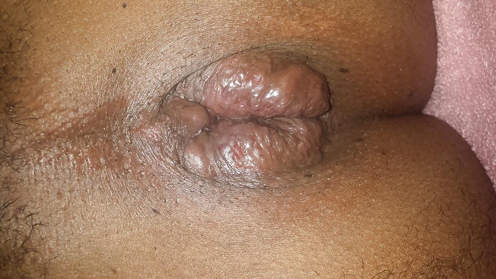 21P Riping my hole