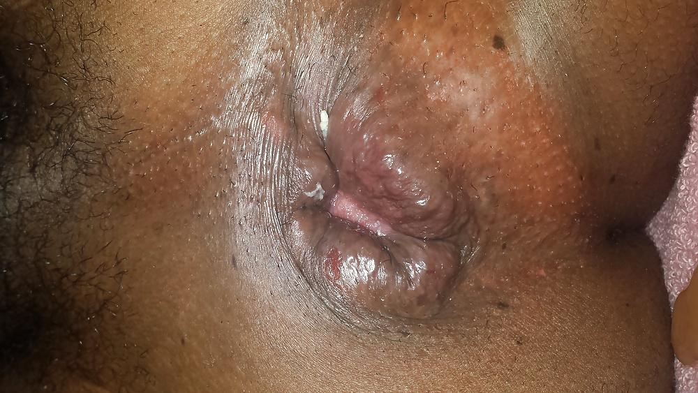 21P Riping my hole