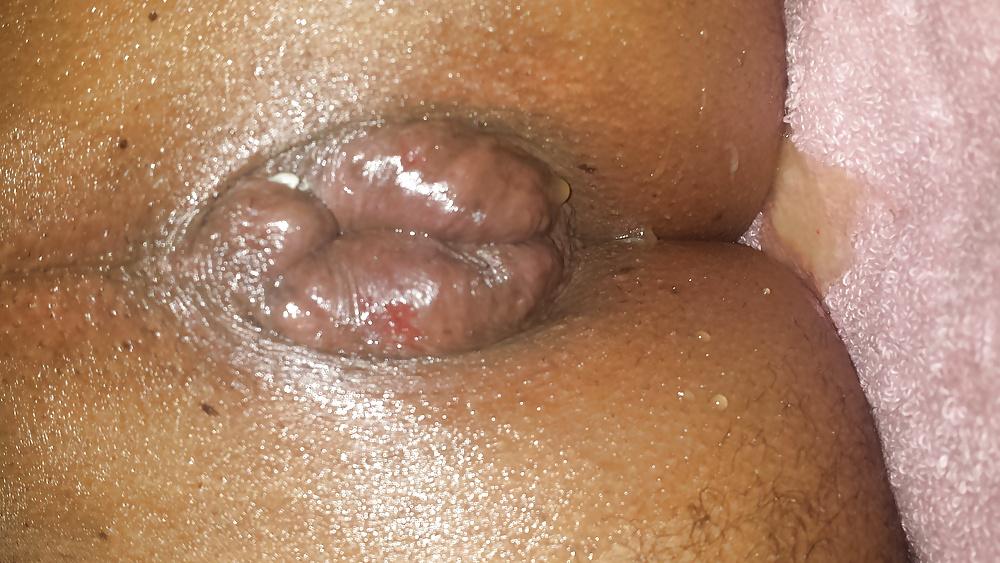21P Riping my hole