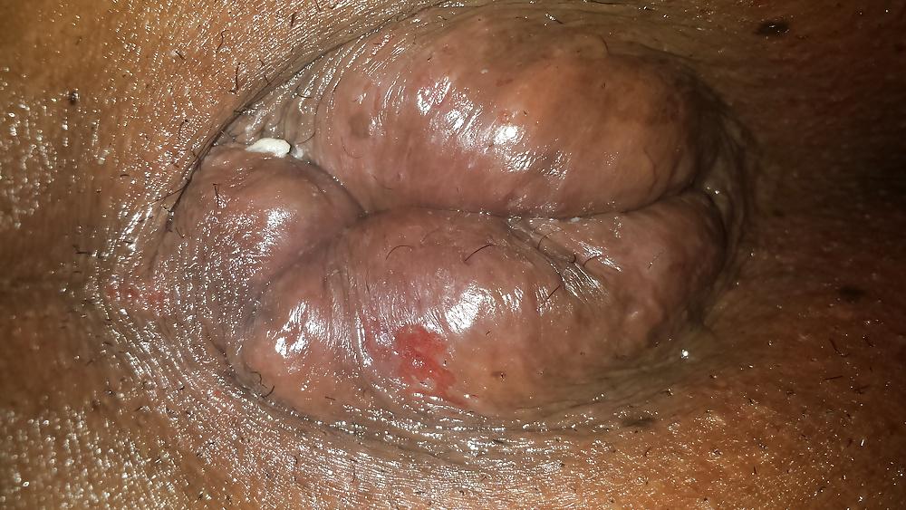 21P Riping my hole
