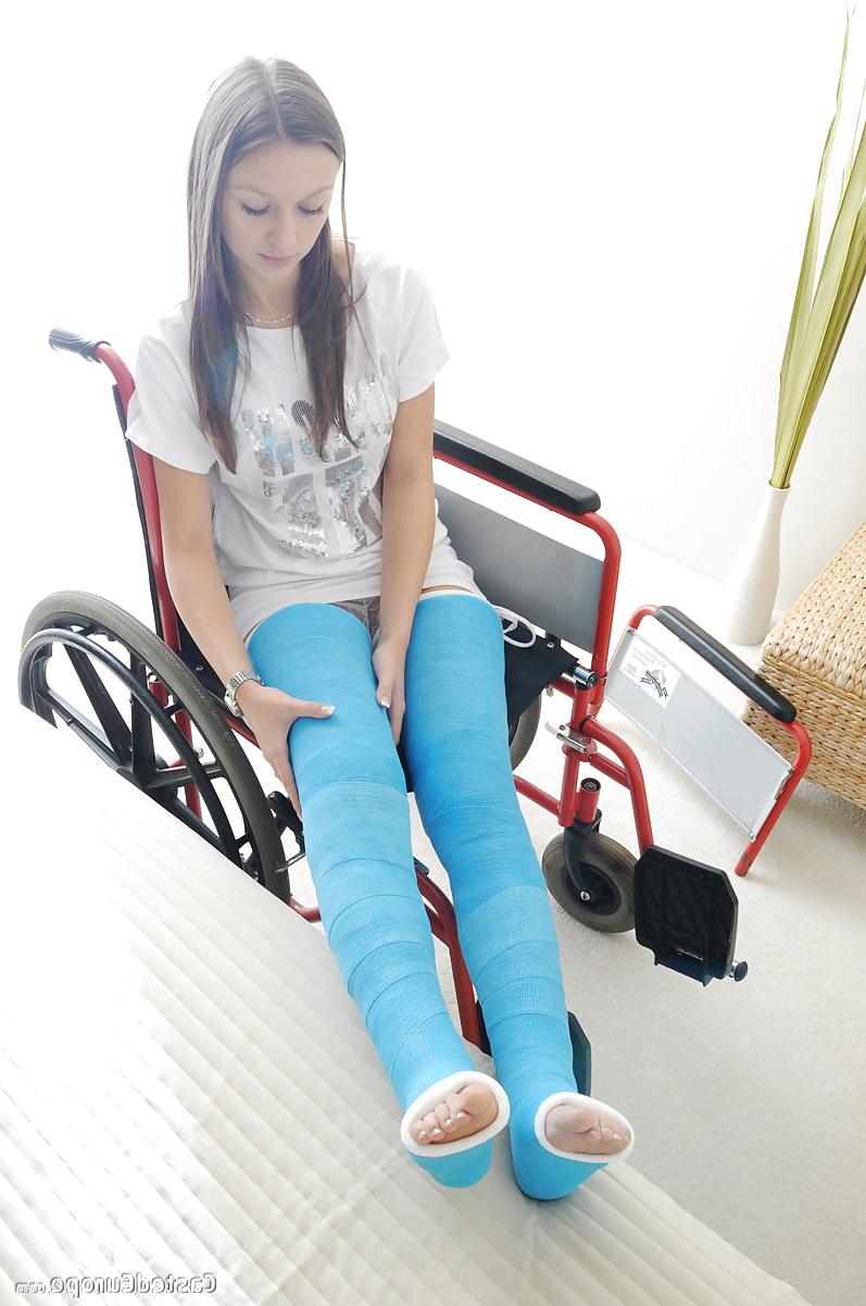 25P Gips - Cast 2