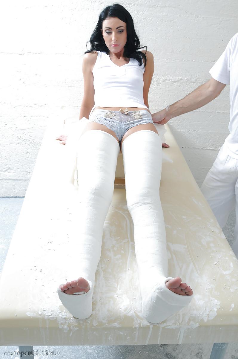 25P Gips - Cast 2