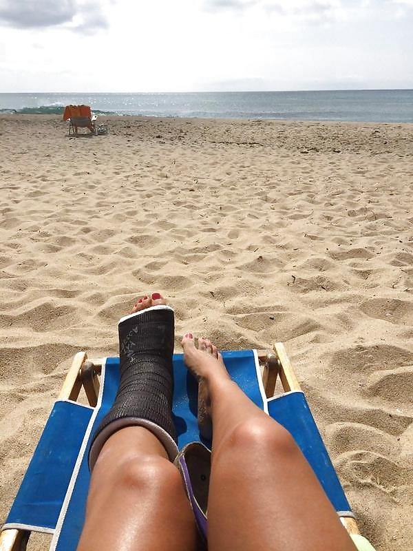 9P Bikini - Leg Cast
