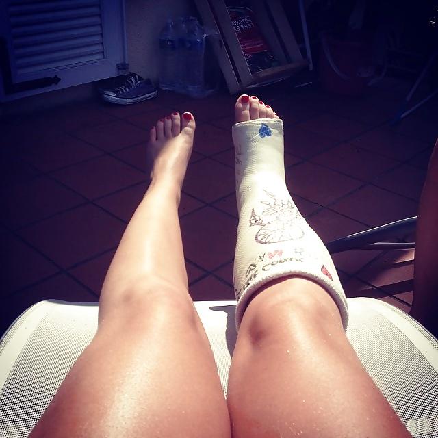 9P Bikini - Leg Cast