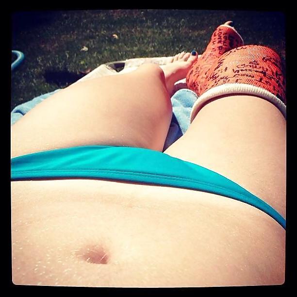 9P Bikini - Leg Cast