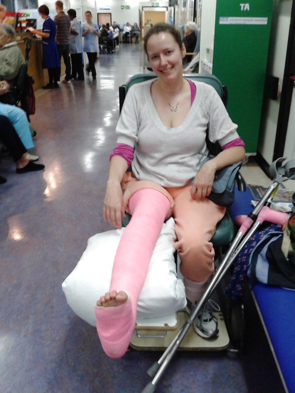 10P Leg cast fetish