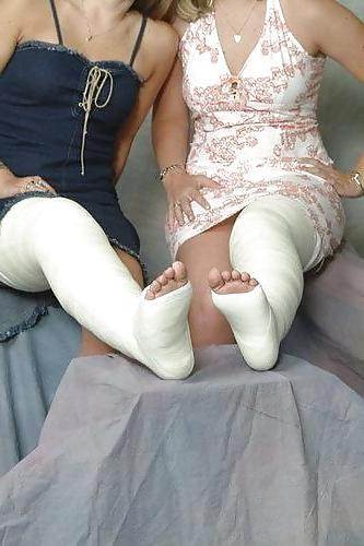 10P Leg cast fetish
