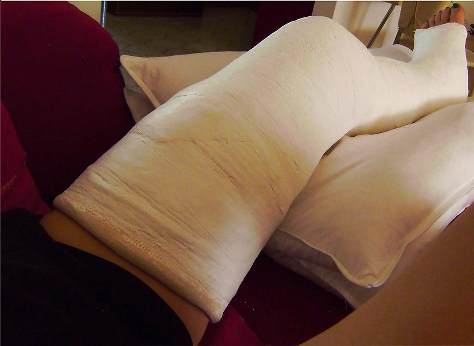 10P Leg cast fetish