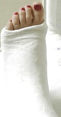 10P Leg cast fetish