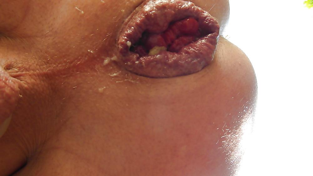 15P Prolasped Gaping and Spread Assholes-Open All Night #38