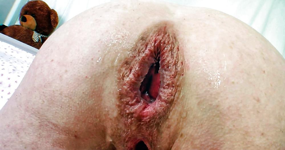15P Prolasped Gaping and Spread Assholes-Open All Night #32
