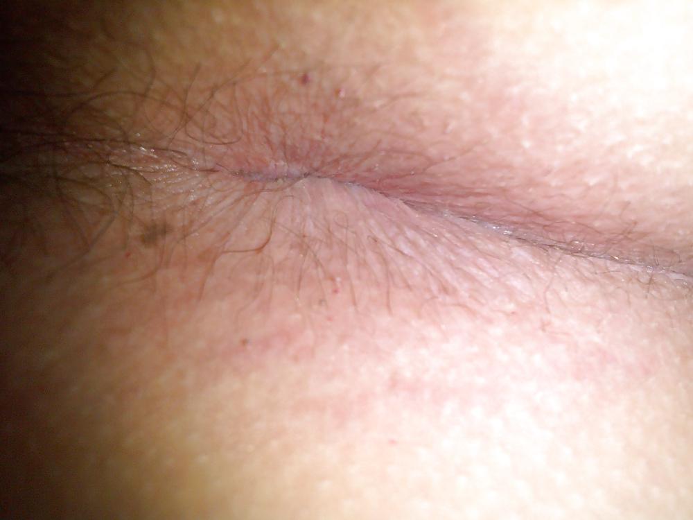 10P My ass hole and my small cock
