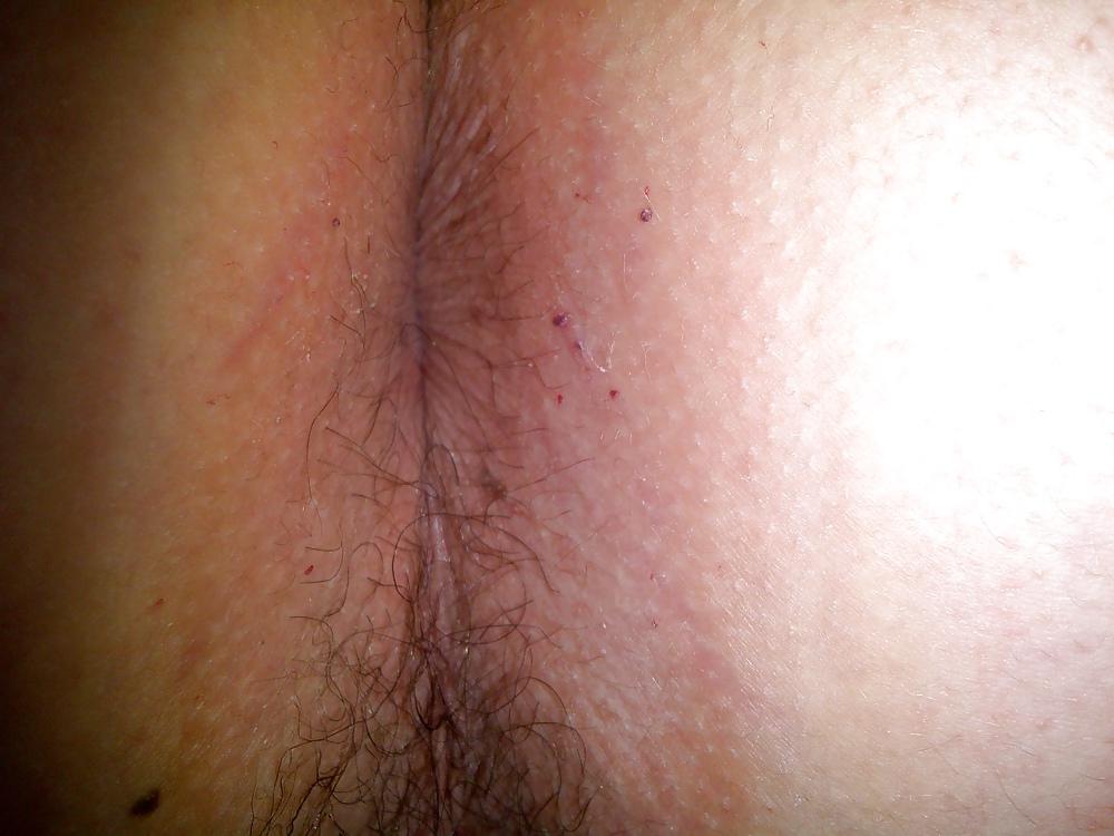 10P My ass hole and my small cock