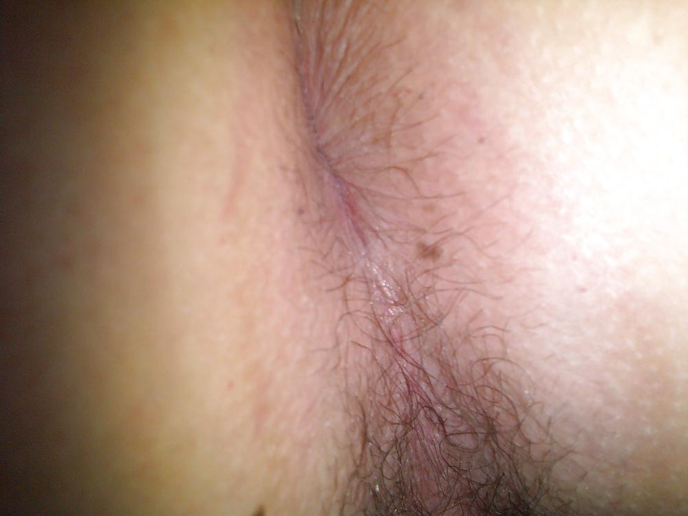 10P My ass hole and my small cock