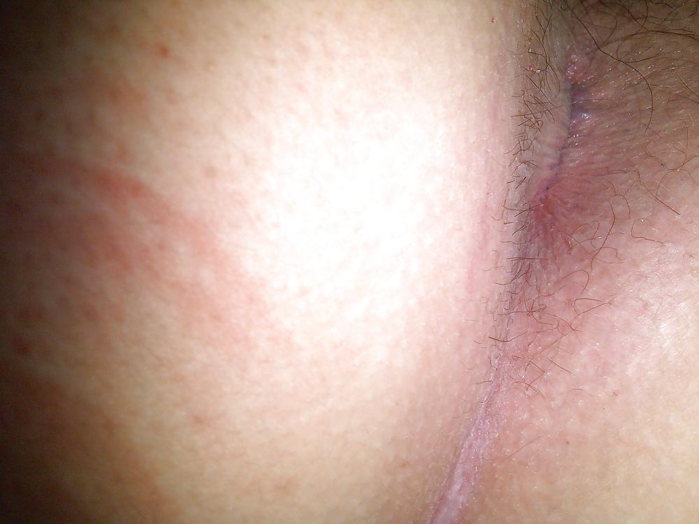 10P My ass hole and my small cock