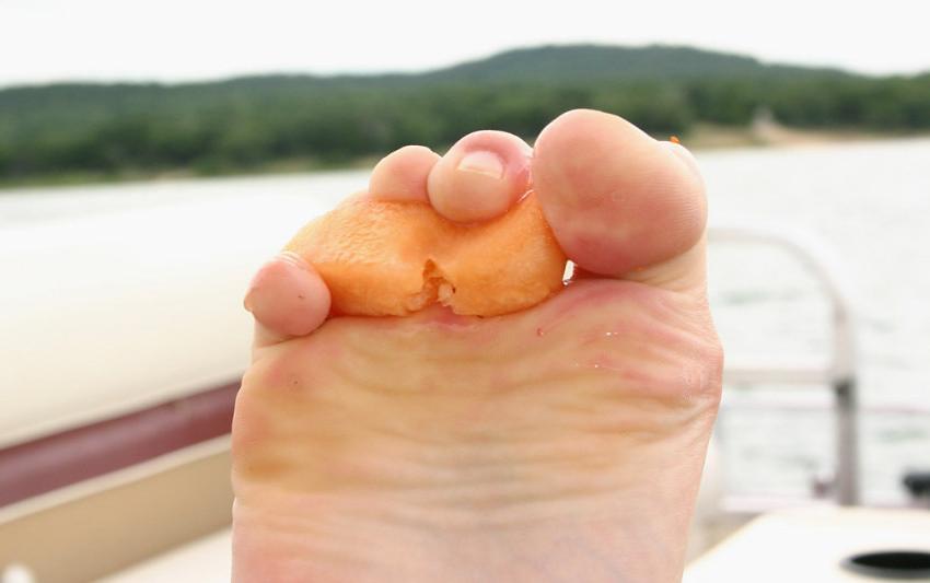 15P Gorgeous amateur teen feet outdoors