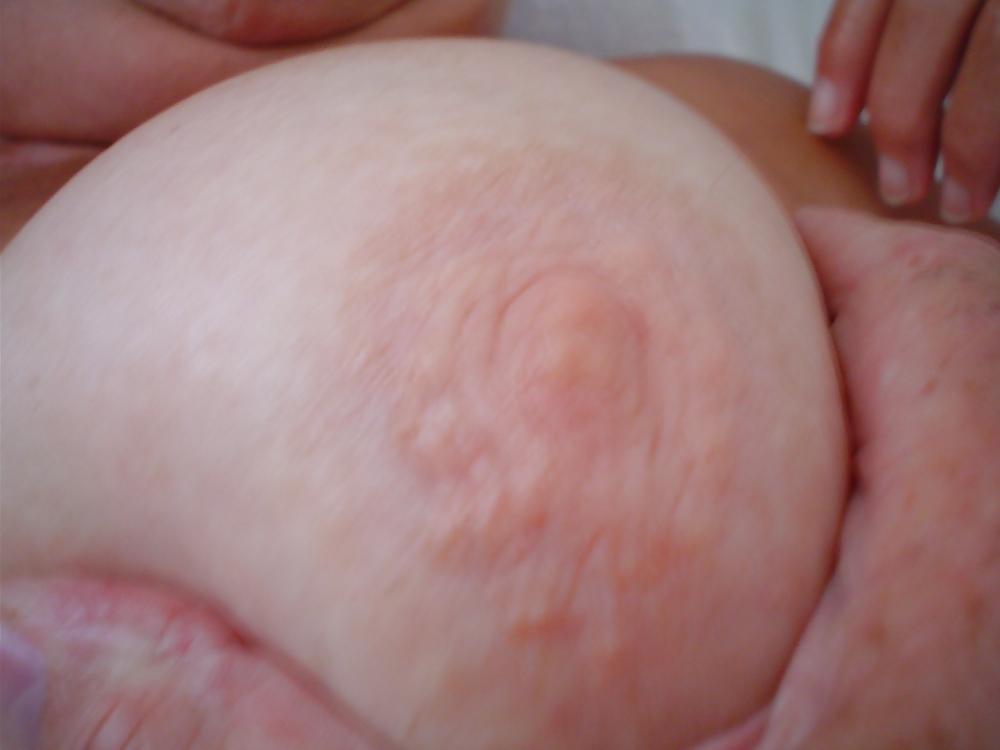 21P Huge tits