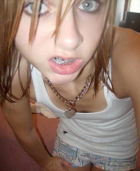 15P Selfshot amateur teen girlfriends with braces