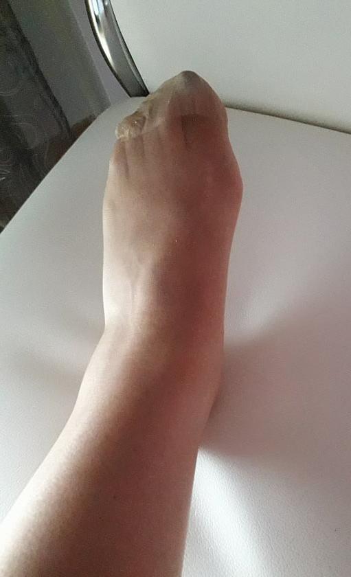 12P 64 yo granny .. what do you want to do her?