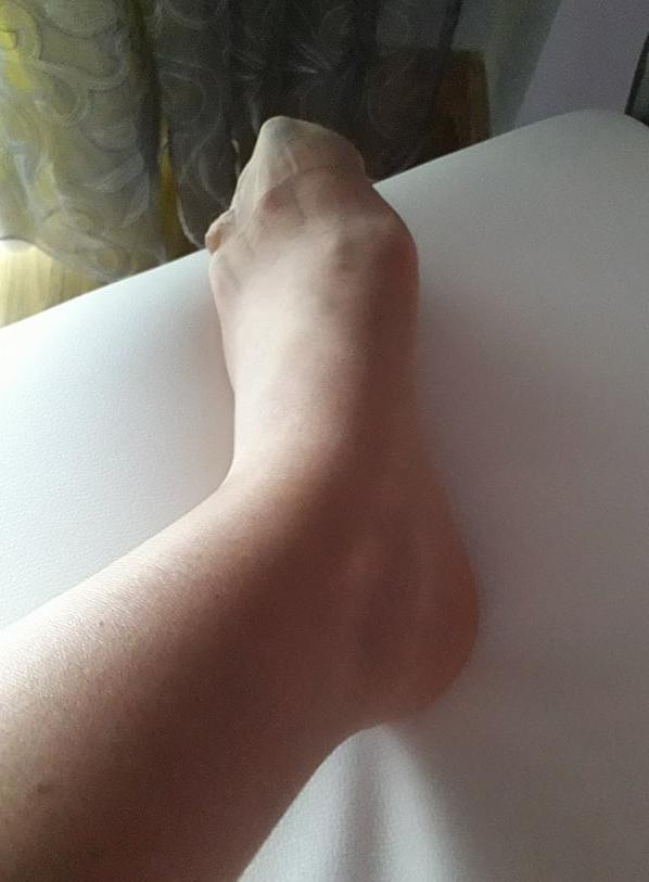 12P 64 yo granny .. what do you want to do her?