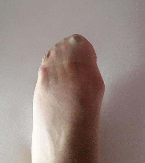 12P 64 yo granny .. what do you want to do her?