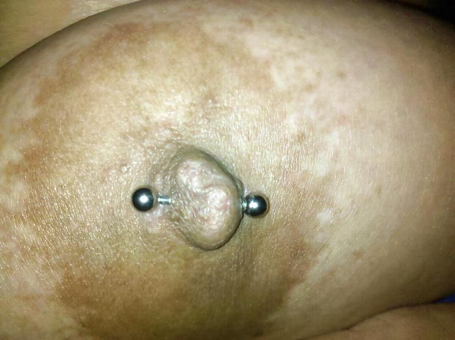25P Huge Tits 2
