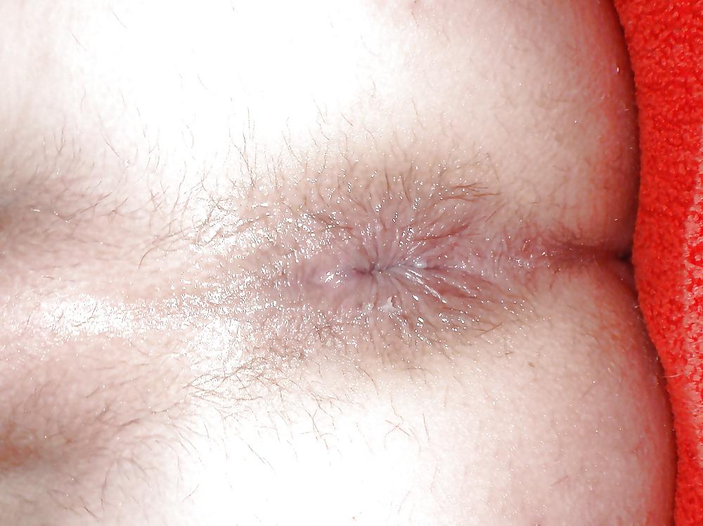 8P Junge Arschloch